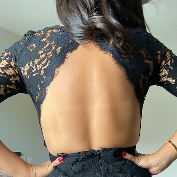 BACKLESS LACE DRESS - Picture 2 of 14